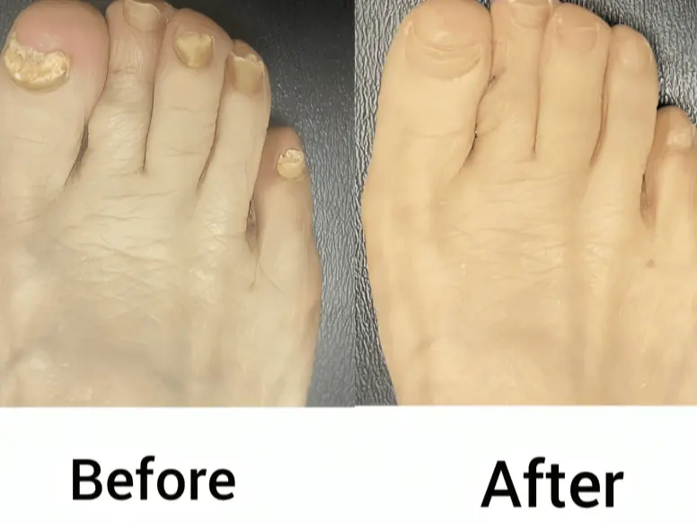 PODOclear  Customer Emily R., Emma T. Texas, USA